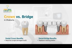 Crown vs. Bridge in Dhakuria